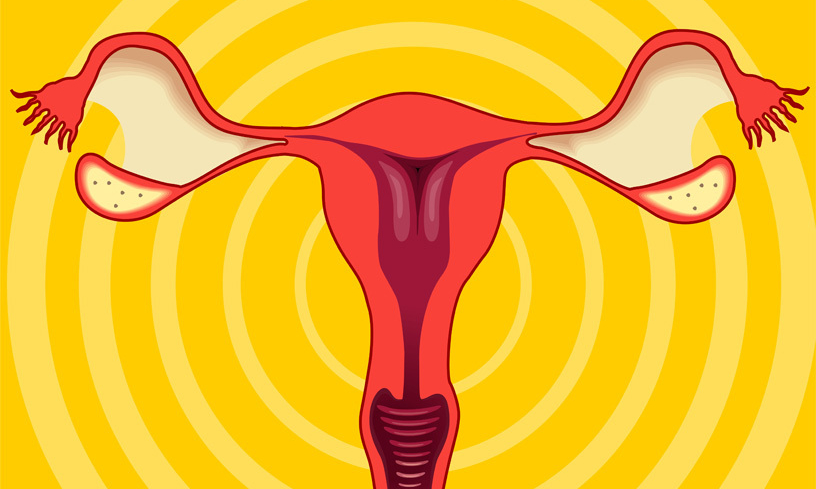 Suurin osa munasarjasyöpään sairastuvista naisista on 60–70-vuotiaita.
